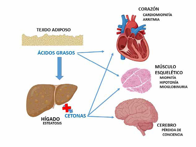 Figura 3. Defecto de la oxidación de ácidos grasos durante el ayuno y el estrés y sus consecuencias en los diferentes órganos afectados